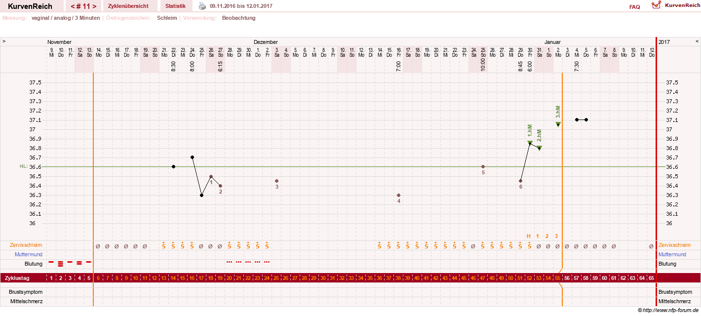 NFP-Kurve User #28365