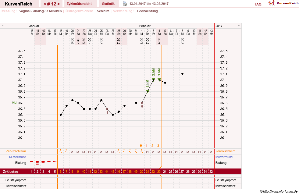 NFP-Kurve User #28365