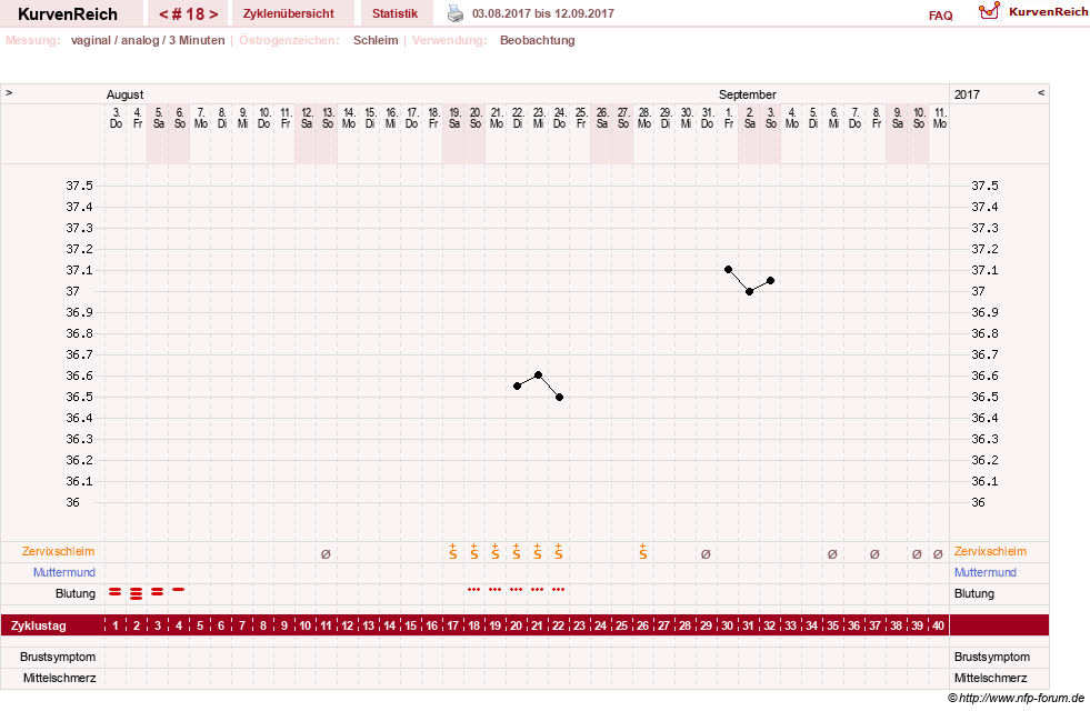 NFP-Kurve User #28365