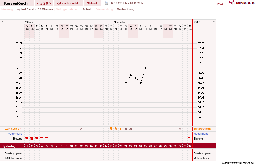 NFP-Kurve User #28365