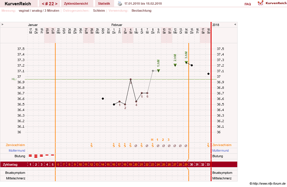 NFP-Kurve User #28365