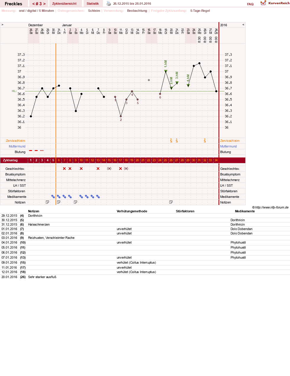 NFP-Kurve User #28396