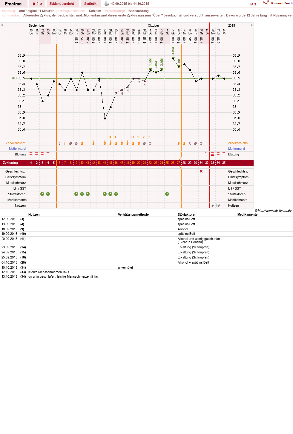 NFP-Kurve User #28499