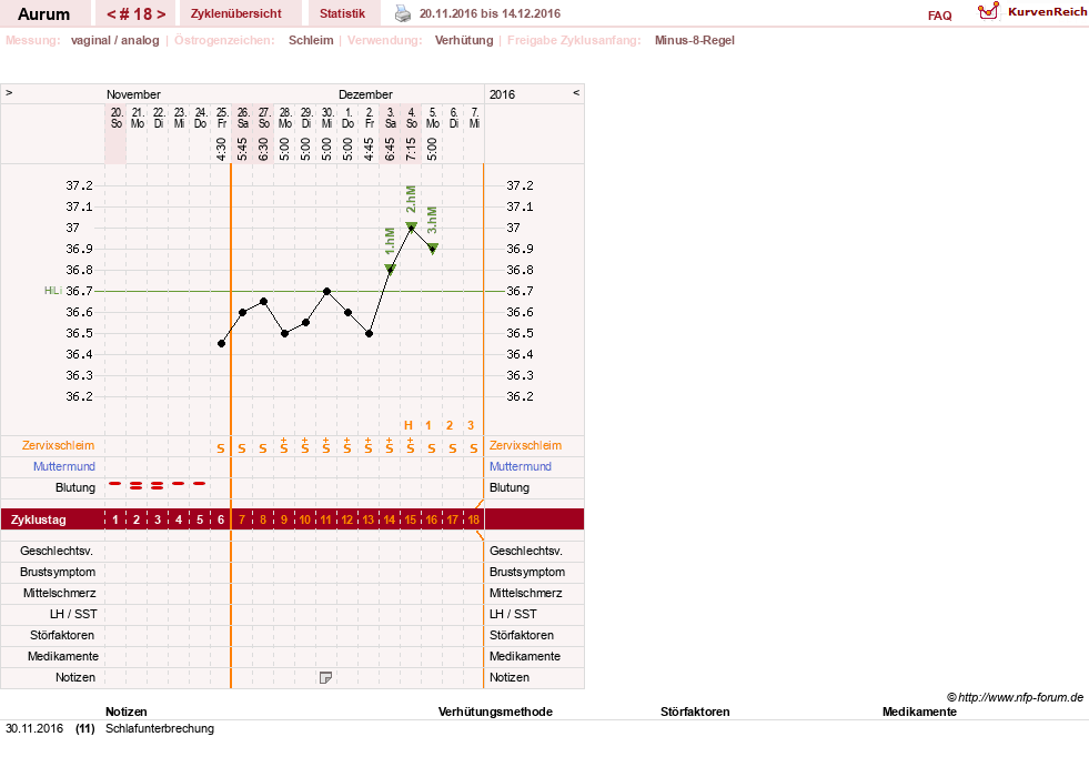 NFP-Kurve User #28513