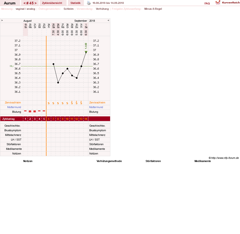 NFP-Kurve User #28513