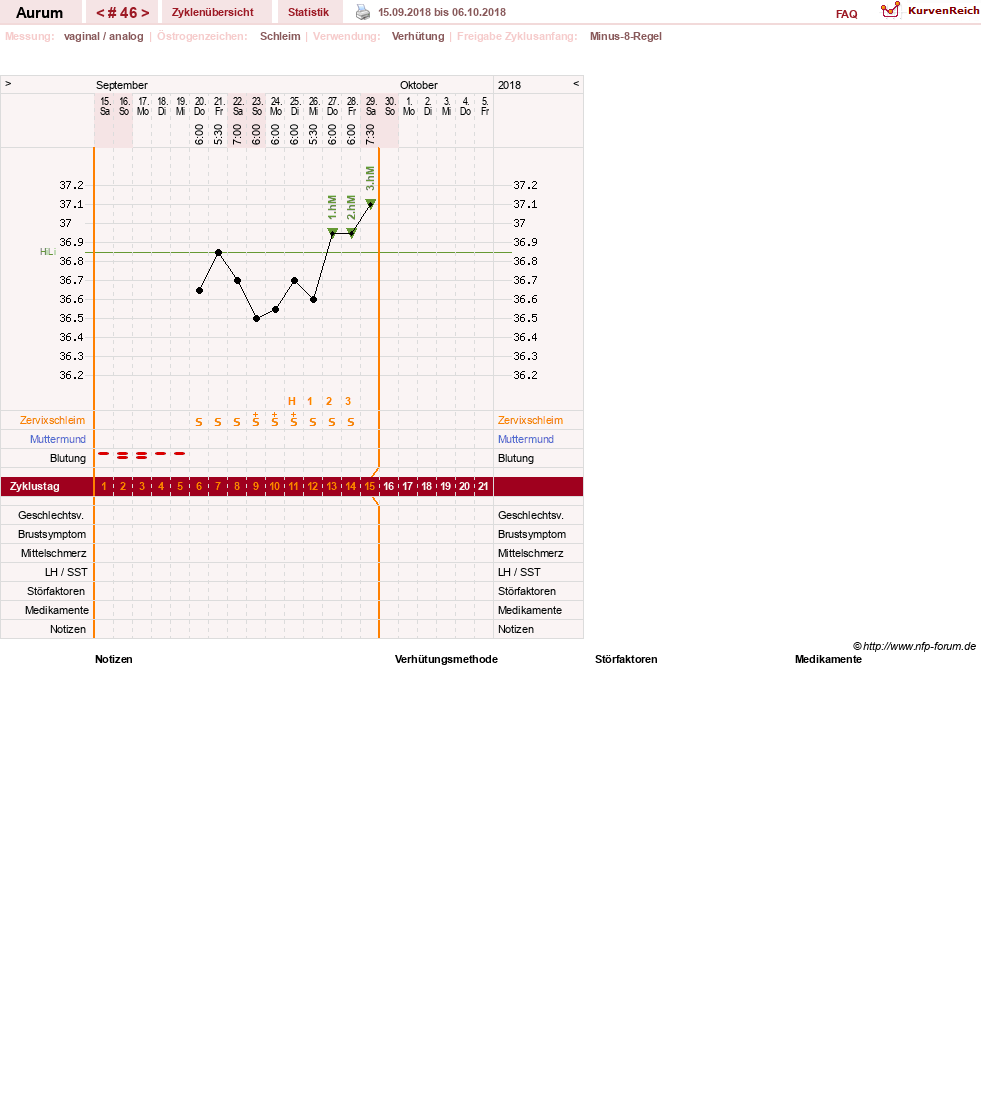 NFP-Kurve User #28513