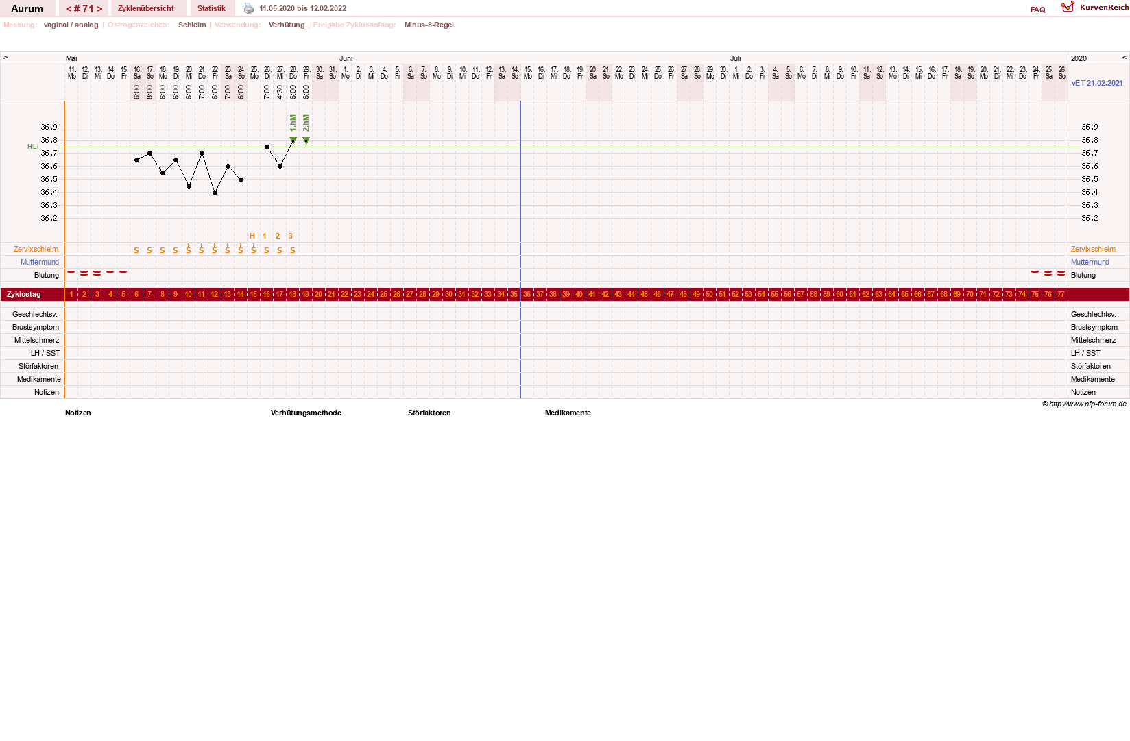 NFP-Kurve User #28513