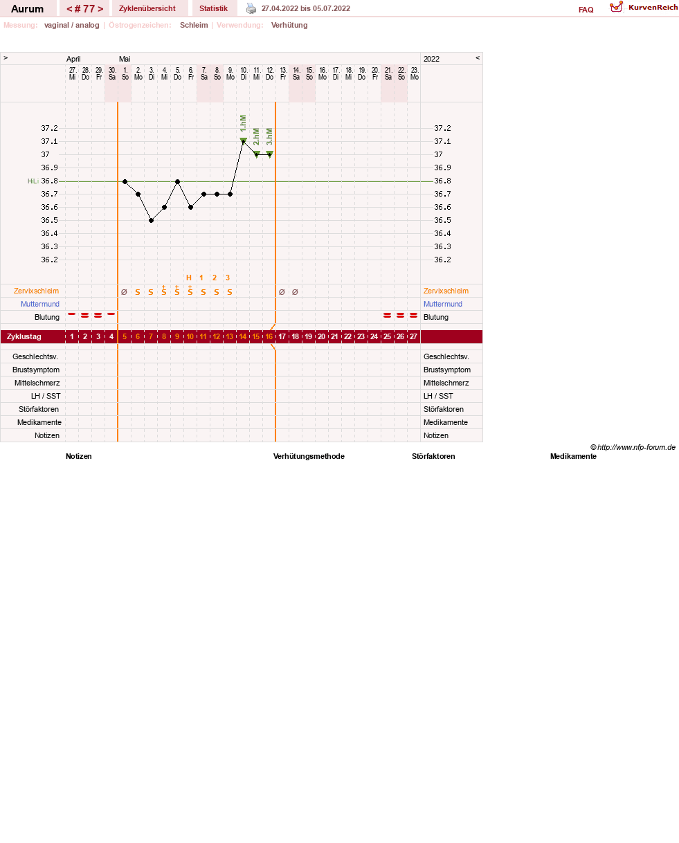 NFP-Kurve User #28513