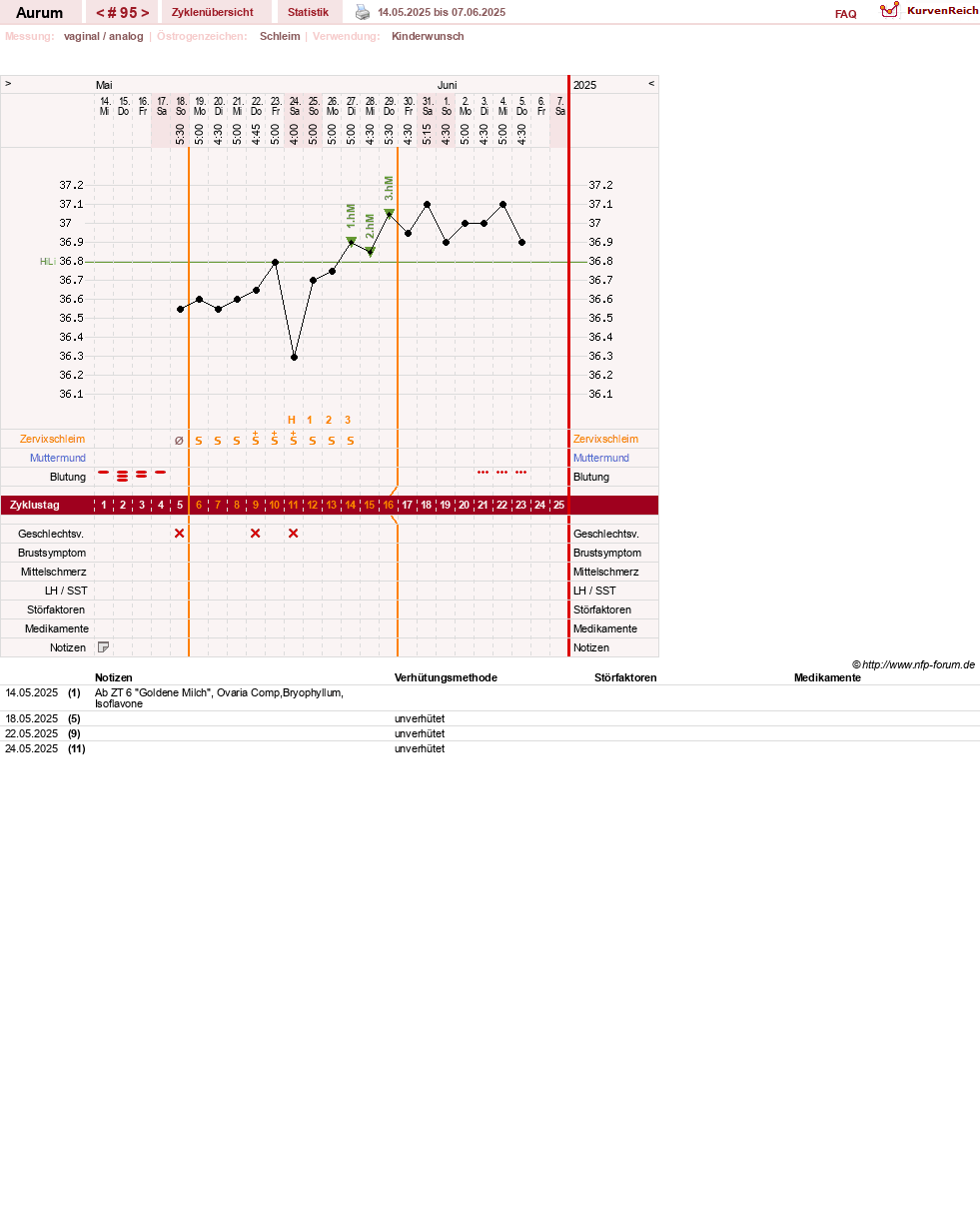 NFP-Kurve User #28513