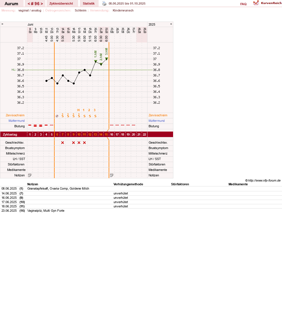 NFP-Kurve User #28513