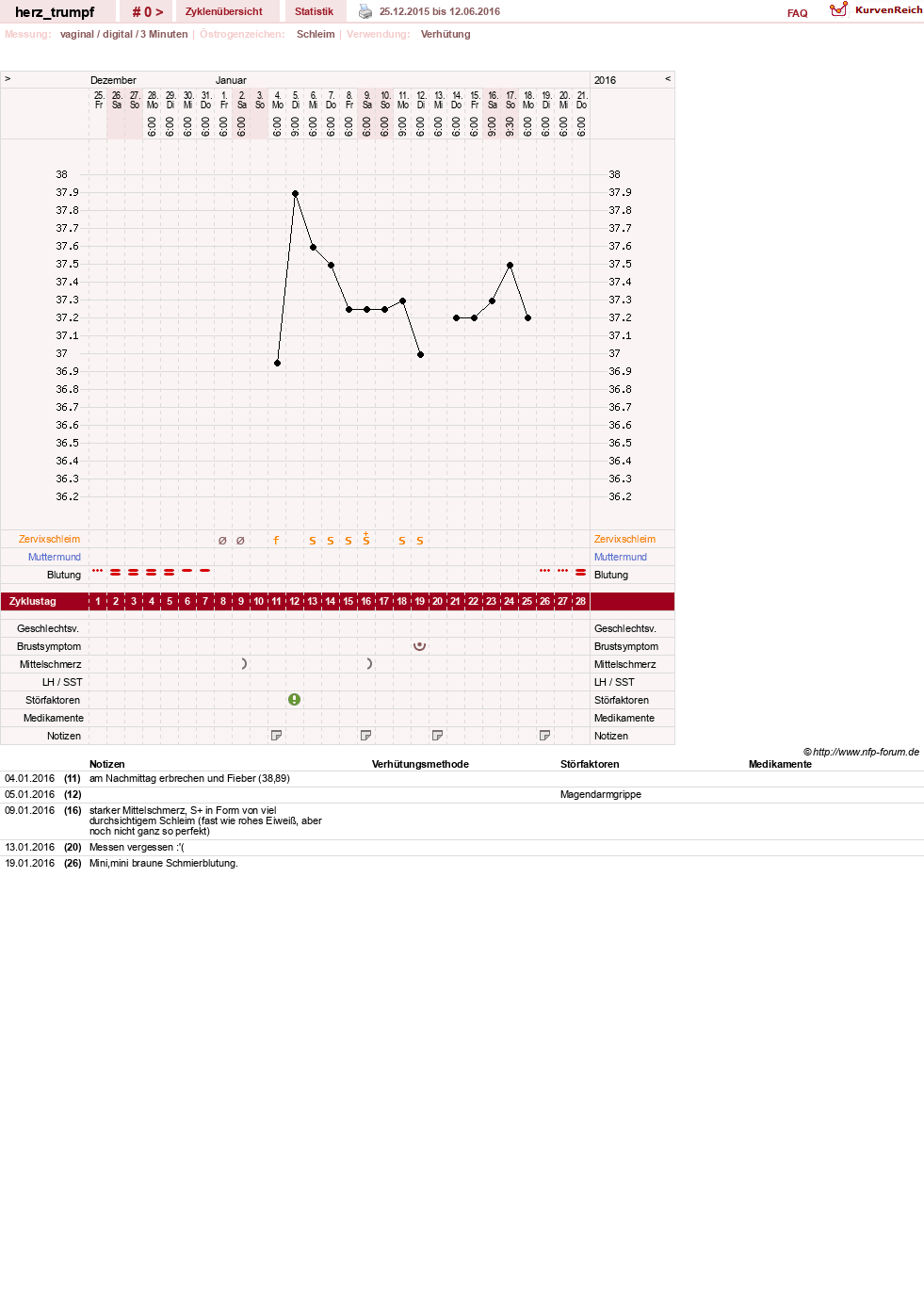 NFP-Kurve User #28558