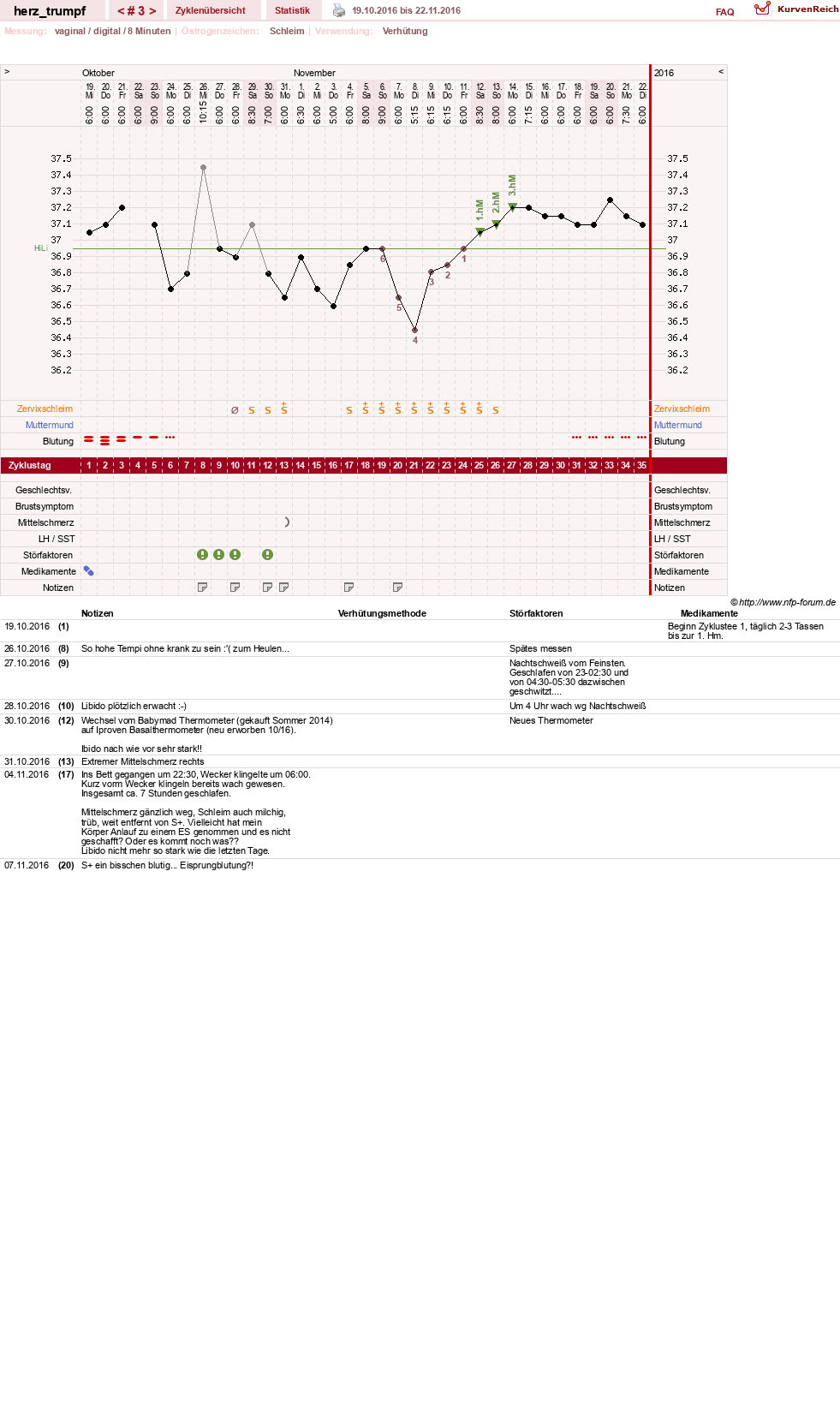 NFP-Kurve User #28558