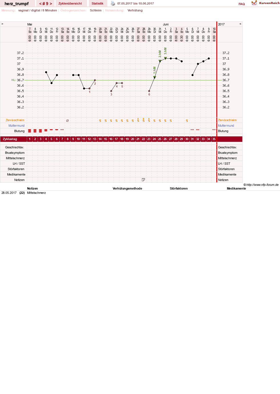 NFP-Kurve User #28558