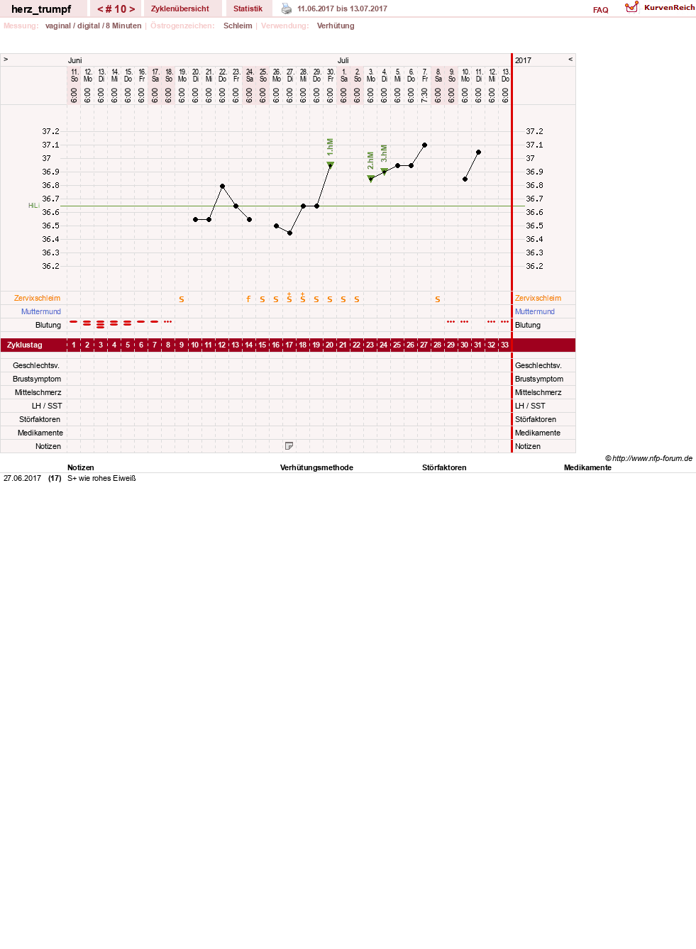 NFP-Kurve User #28558