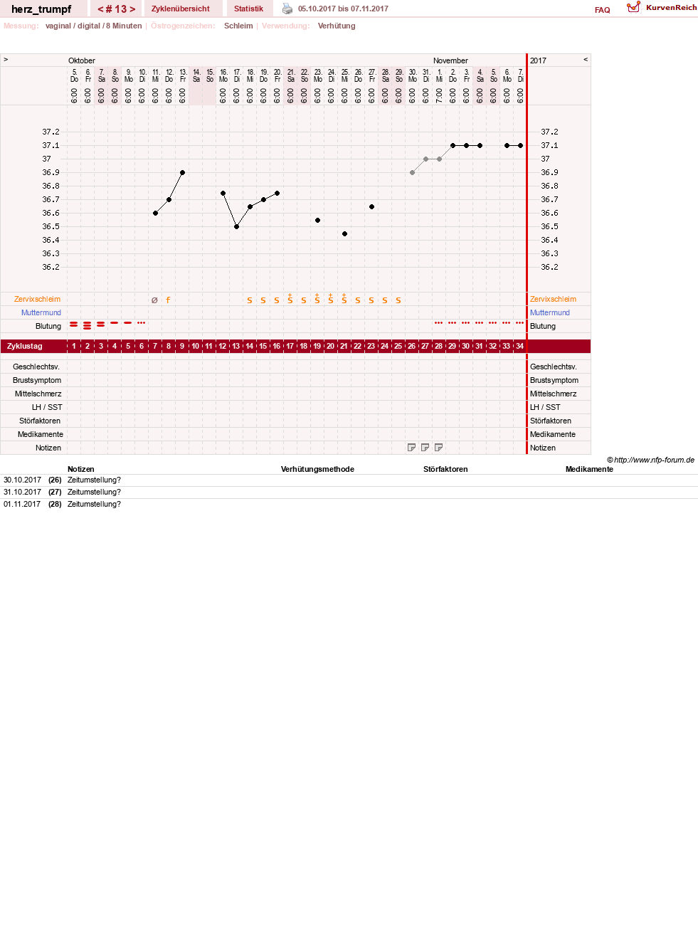 NFP-Kurve User #28558