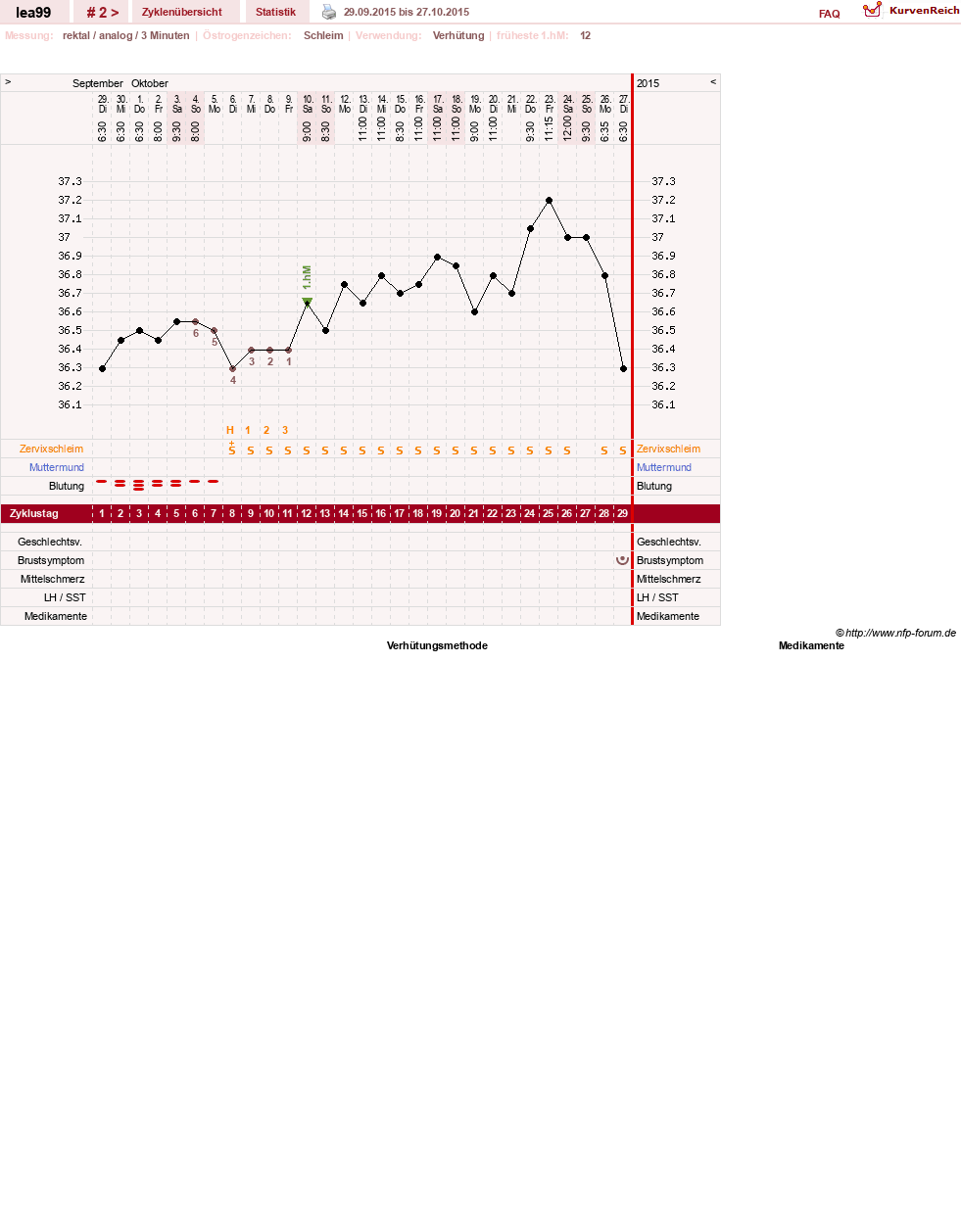 NFP-Kurve User #28624