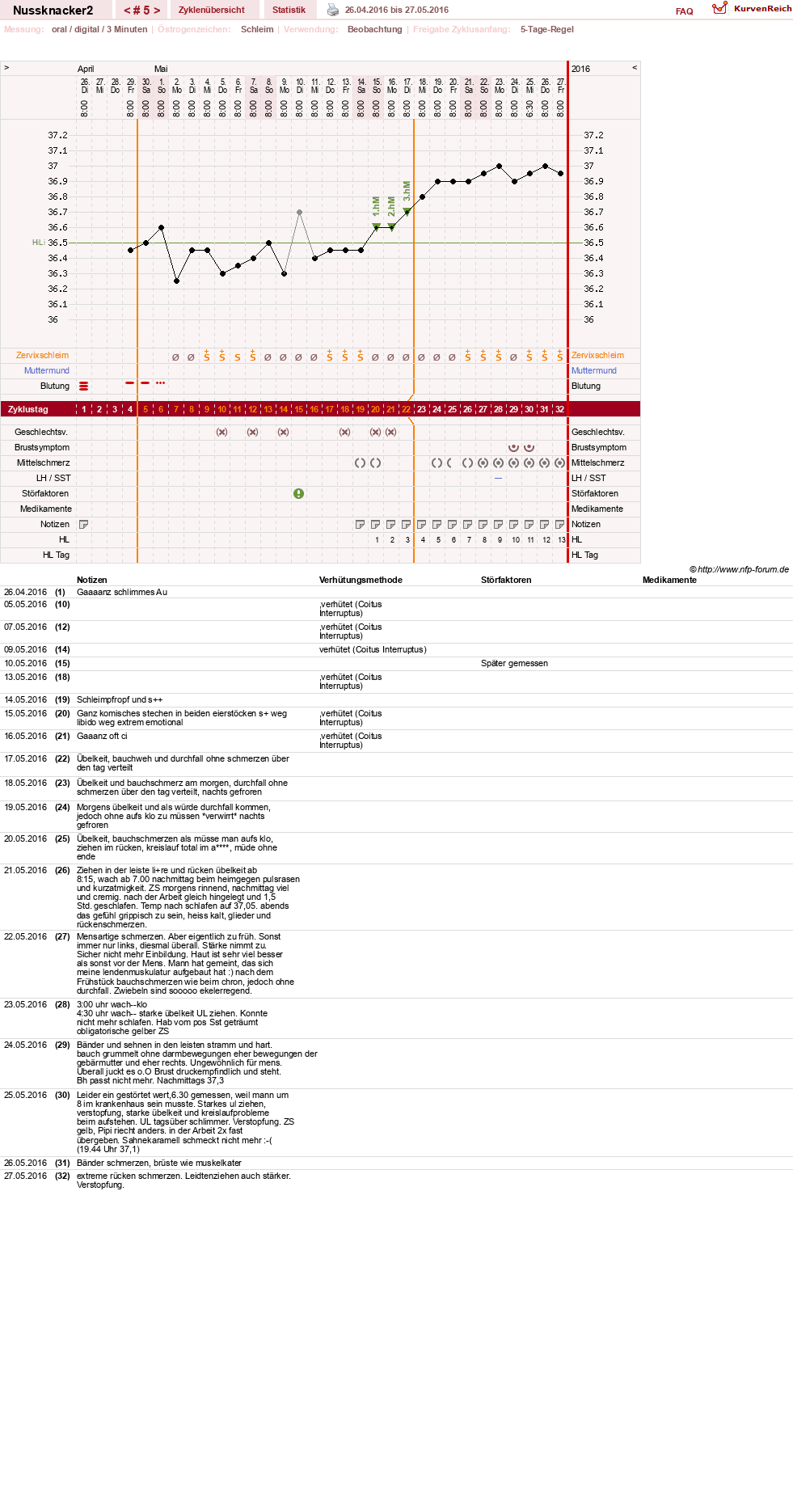 NFP-Kurve User #28855