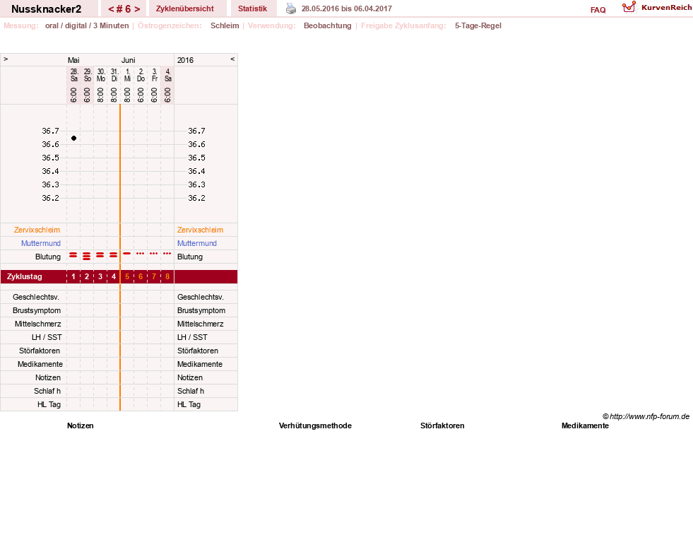 NFP-Kurve User #28855