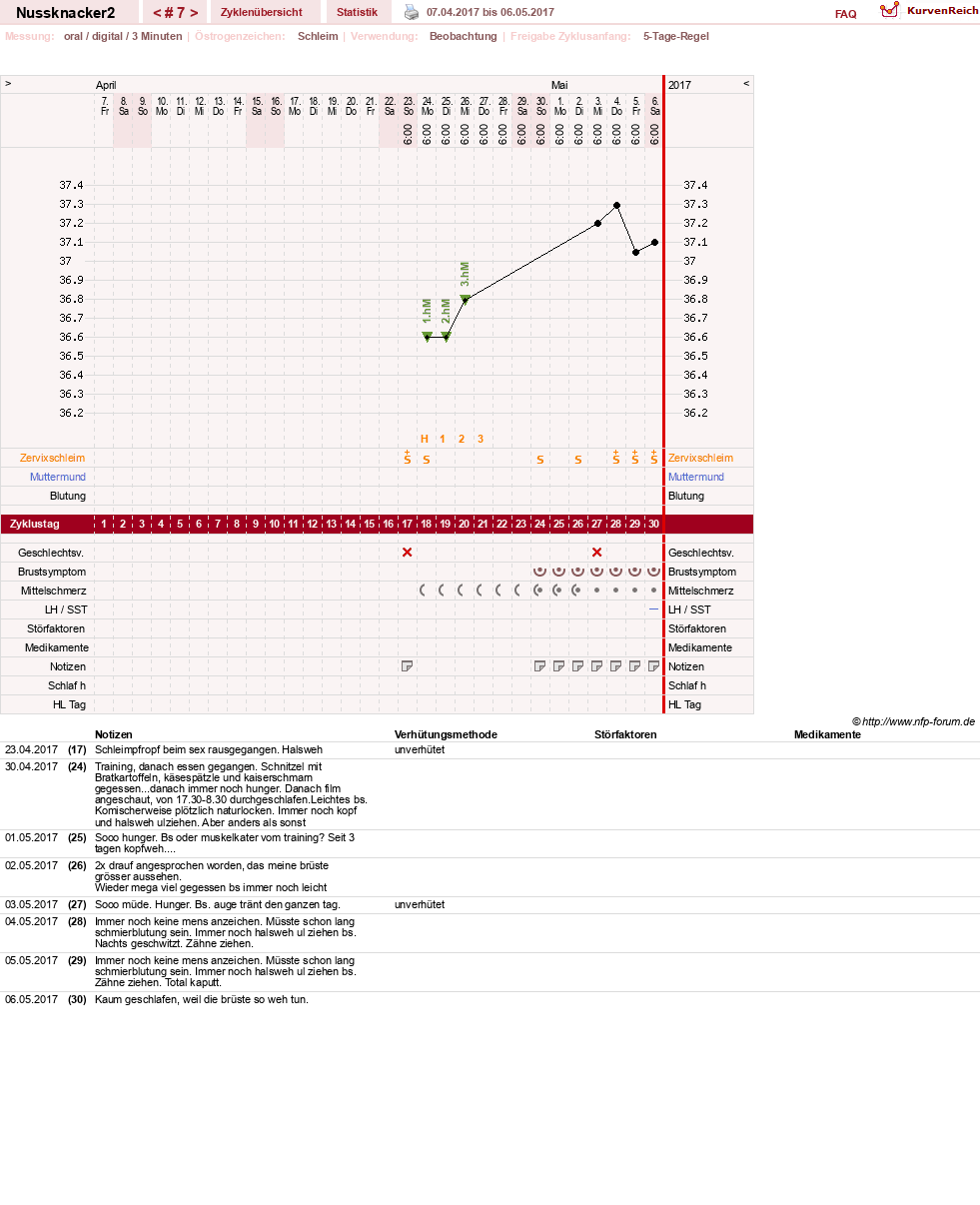 NFP-Kurve User #28855
