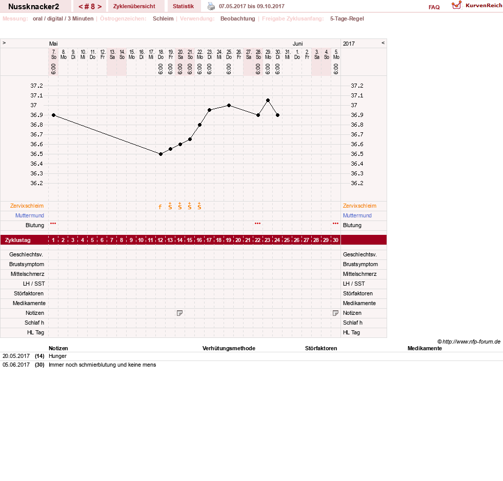 NFP-Kurve User #28855