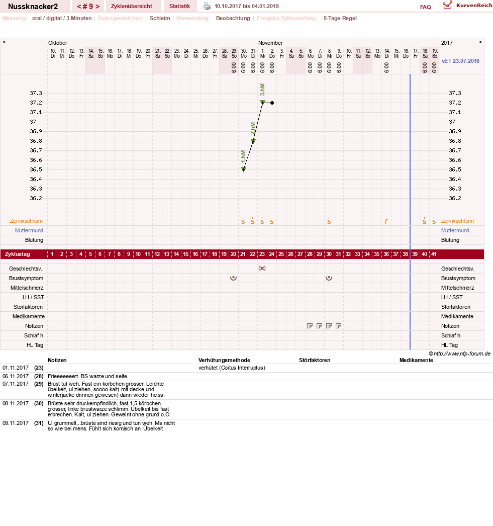 NFP-Kurve User #28855