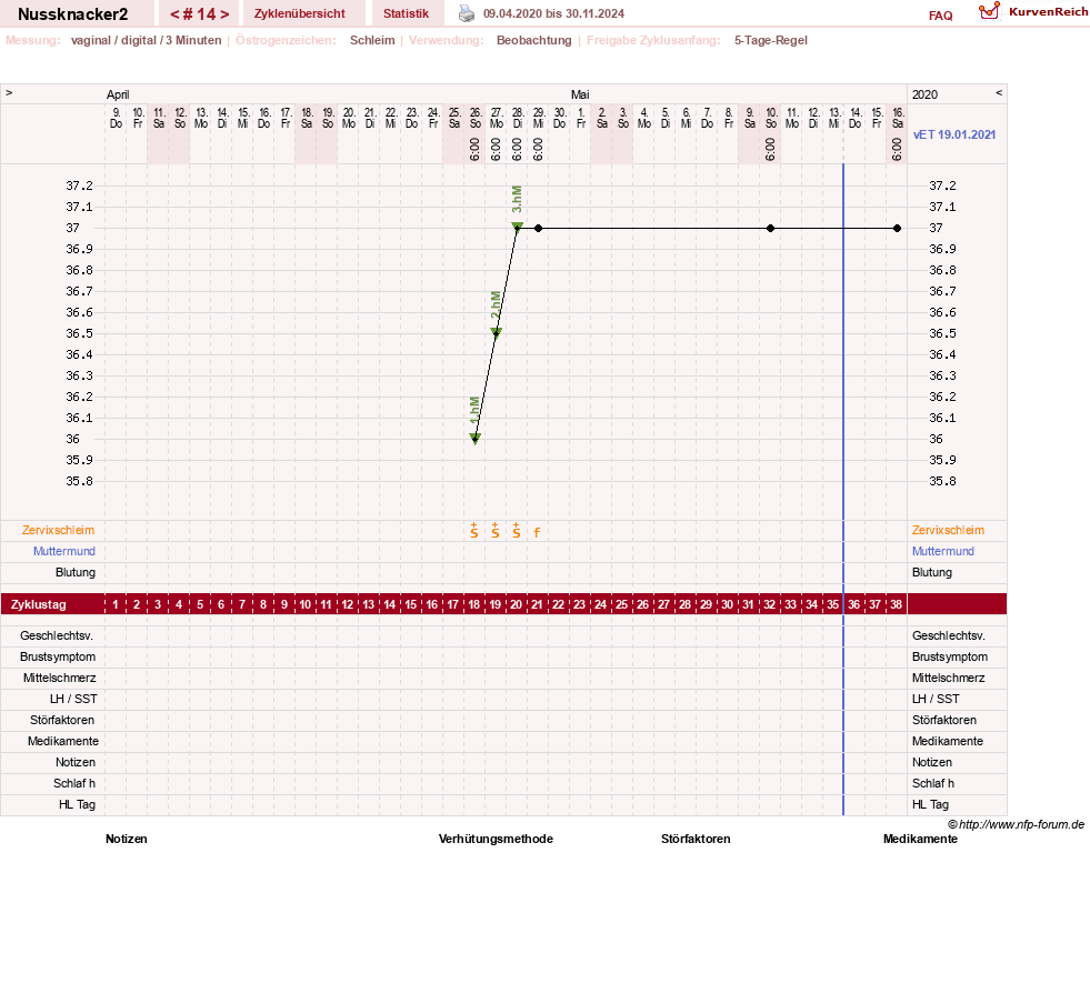 NFP-Kurve User #28855