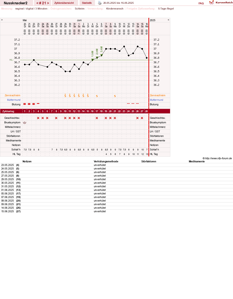 NFP-Kurve User #28855