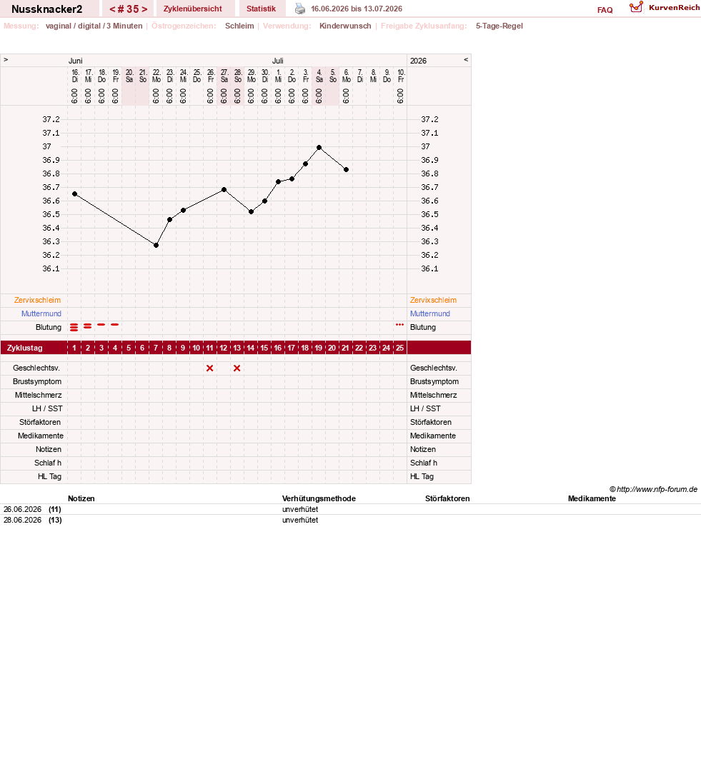 NFP-Kurve User #28855