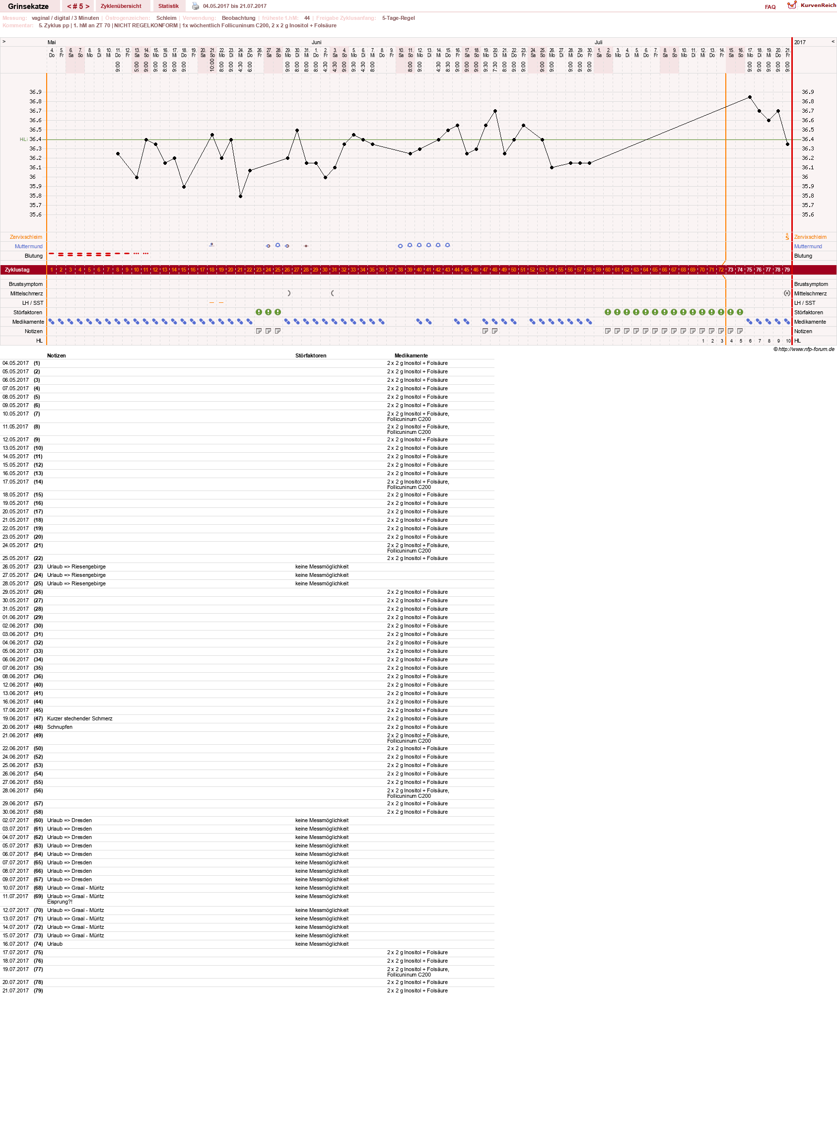 NFP-Kurve User #28867