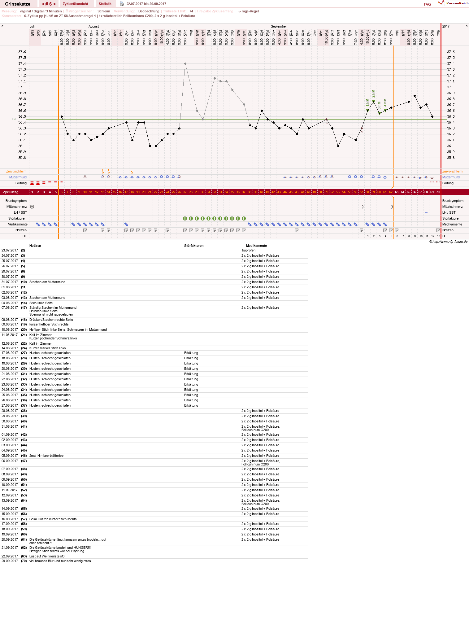 NFP-Kurve User #28867