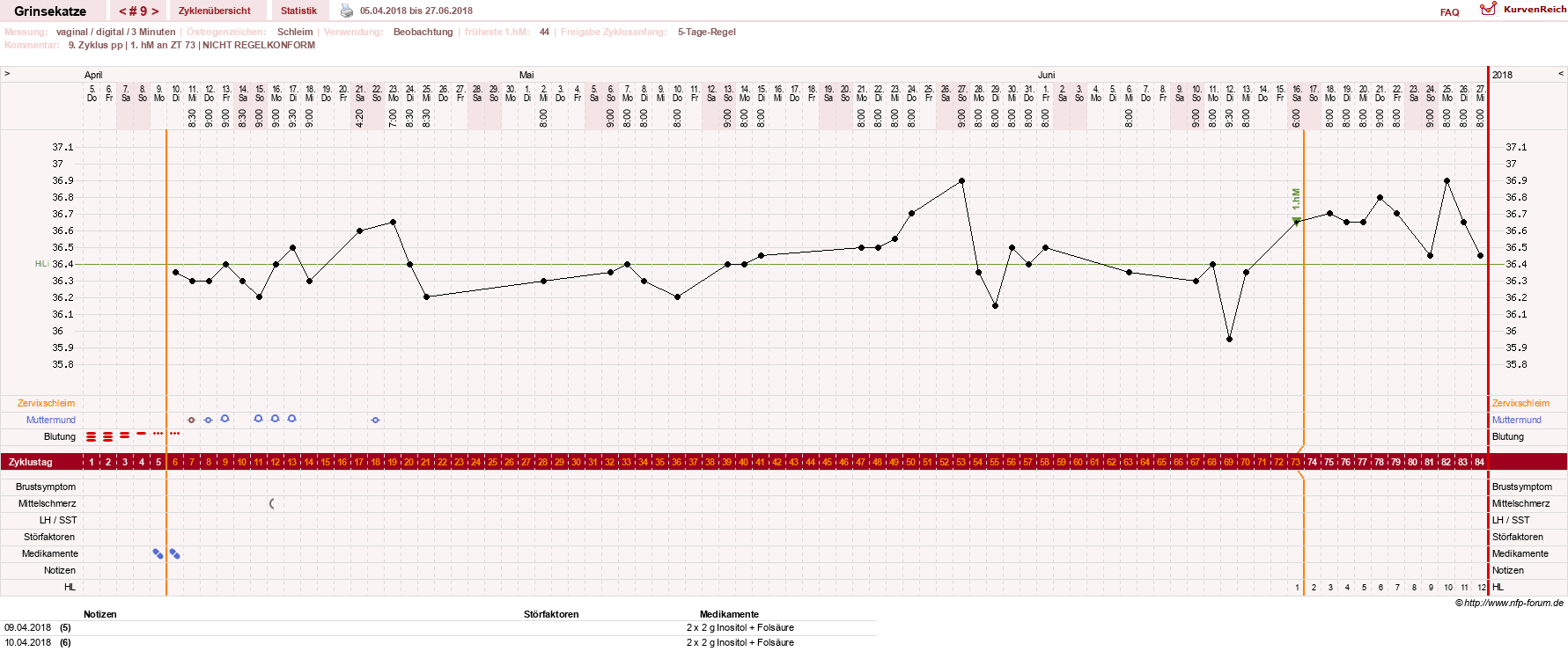 NFP-Kurve User #28867