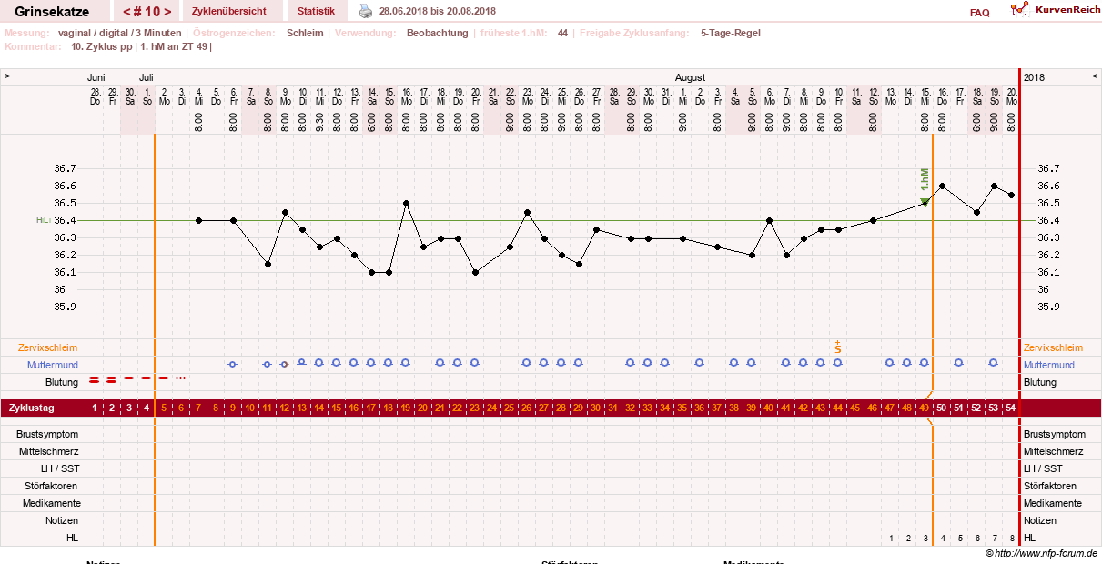NFP-Kurve User #28867