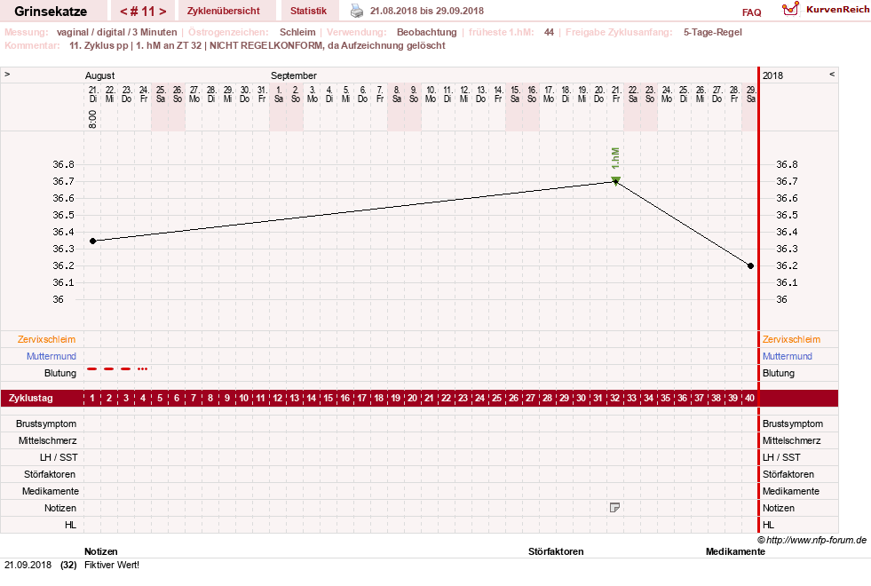 NFP-Kurve User #28867