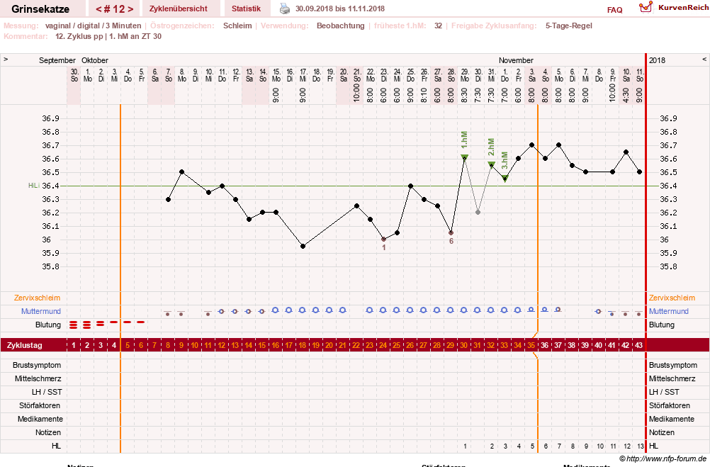 NFP-Kurve User #28867