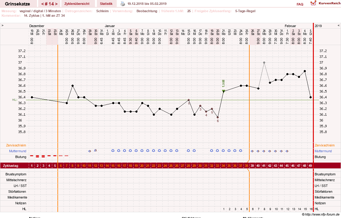NFP-Kurve User #28867