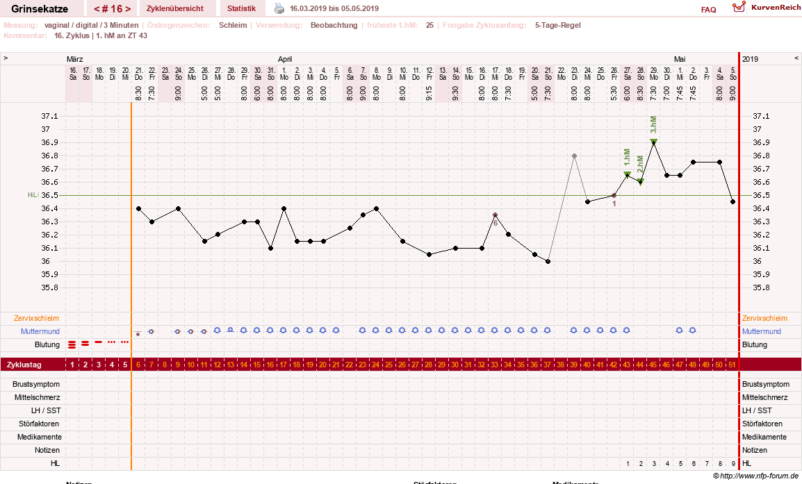 NFP-Kurve User #28867
