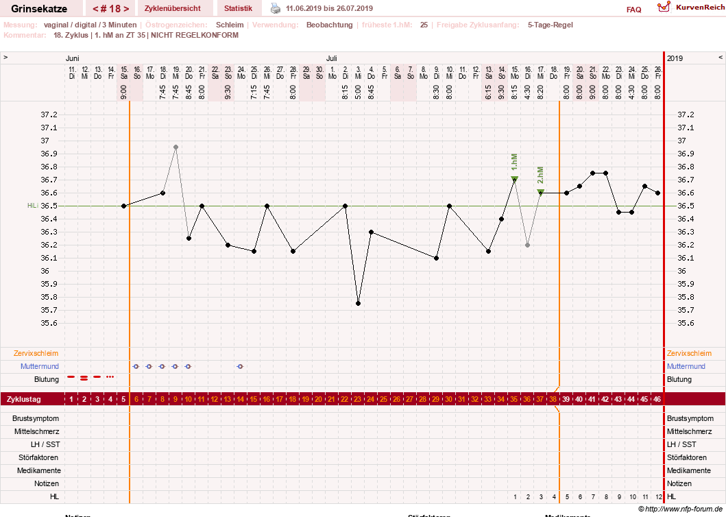 NFP-Kurve User #28867