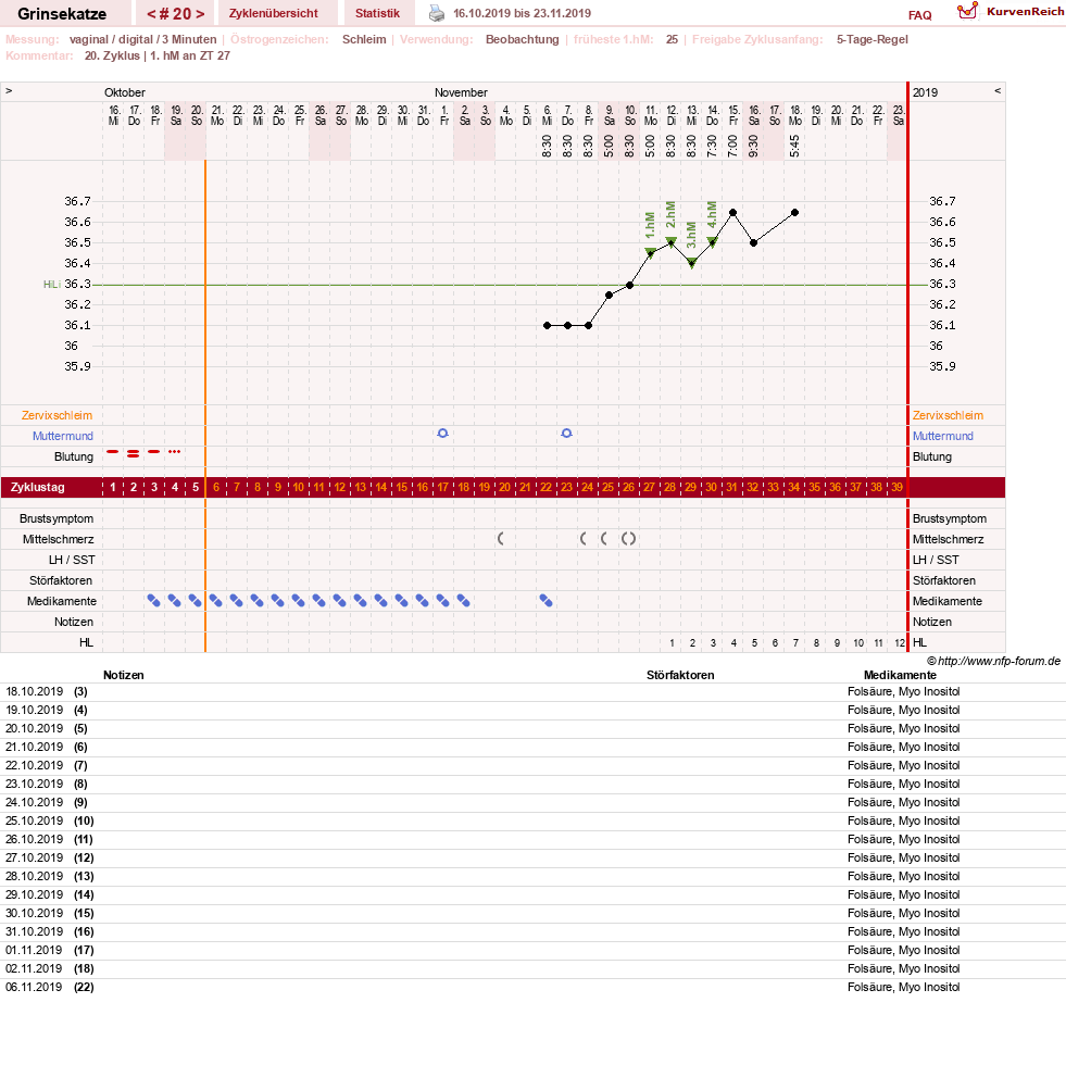 NFP-Kurve User #28867