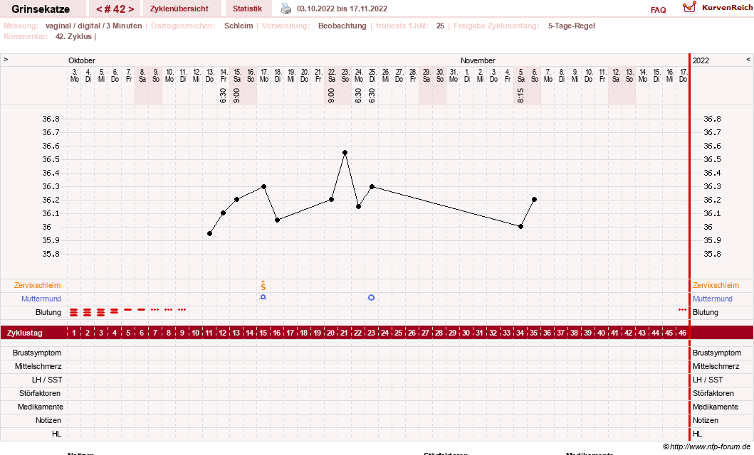 NFP-Kurve User #28867