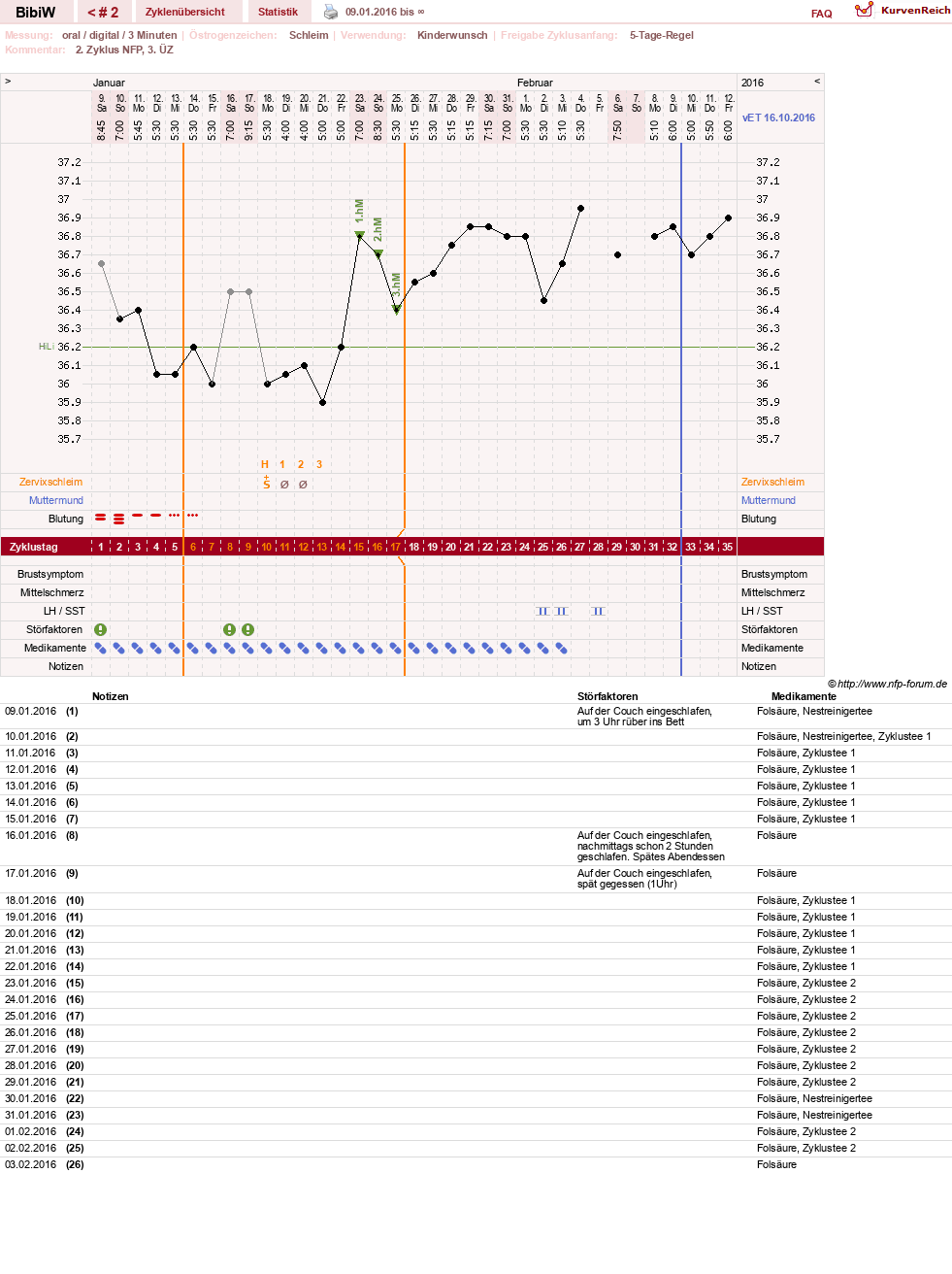 NFP-Kurve User #28869