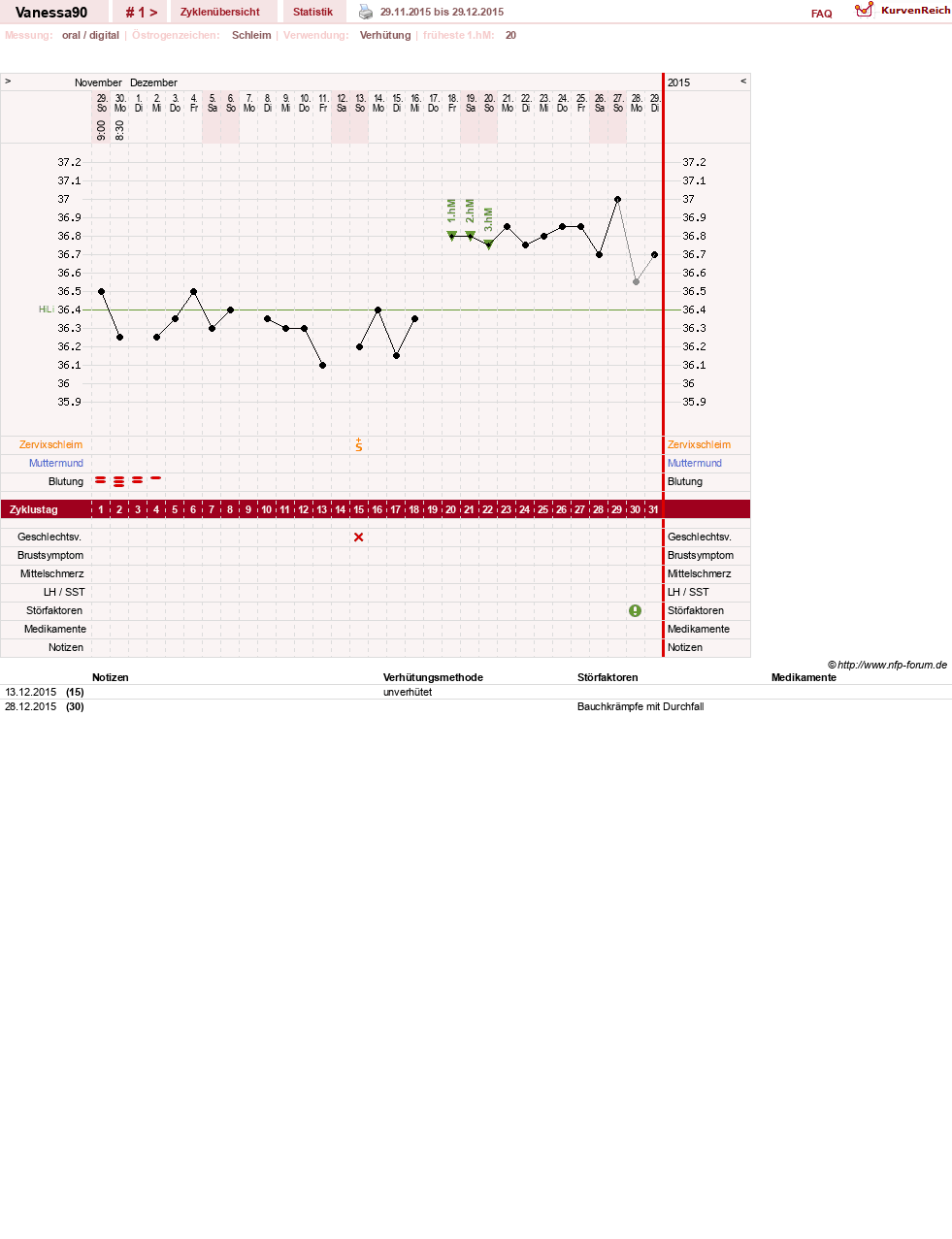 NFP-Kurve User #28870