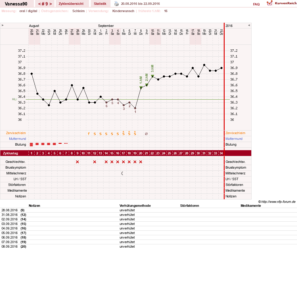 NFP-Kurve User #28870