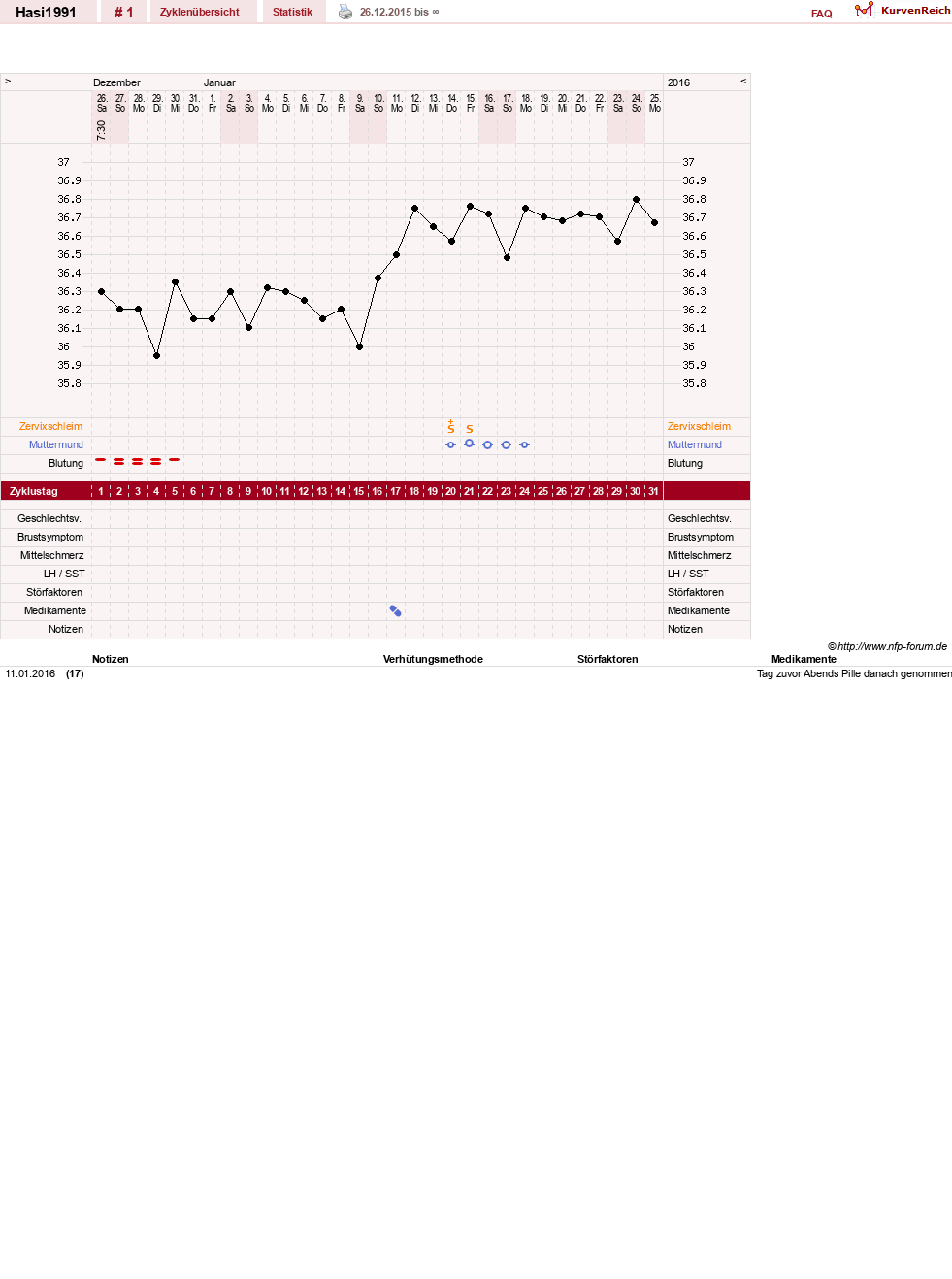 NFP-Kurve User #28943