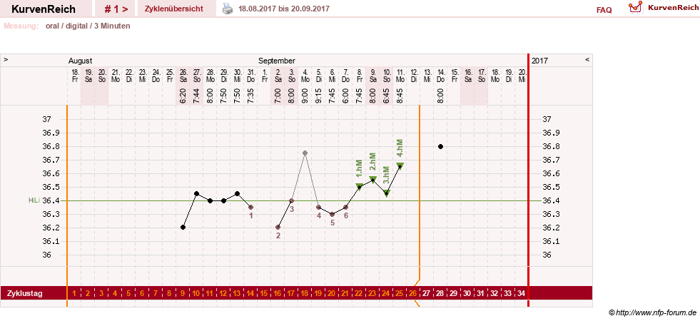 NFP-Kurve User #28972