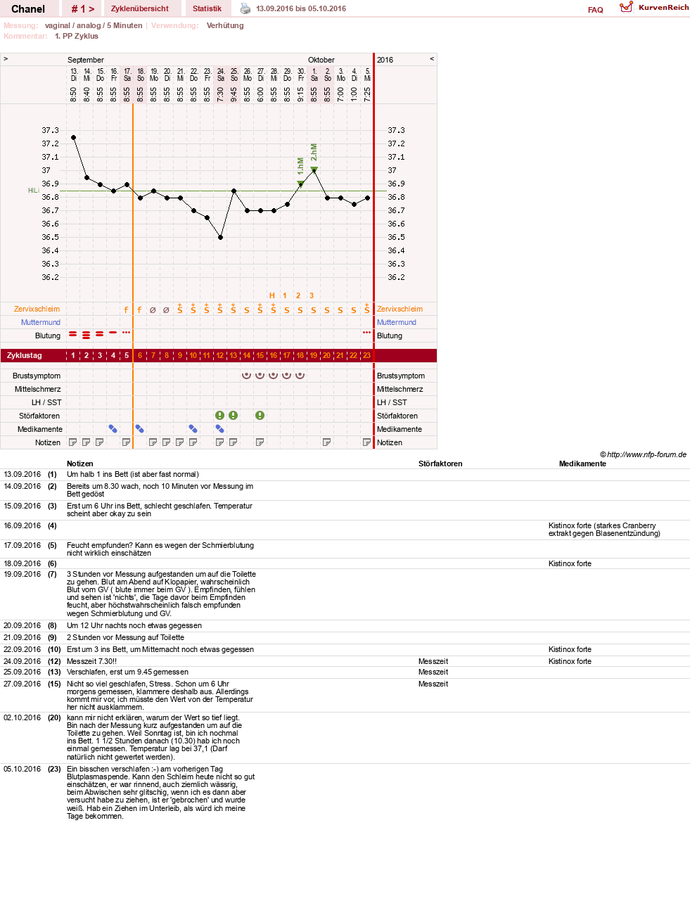NFP-Kurve User #29040