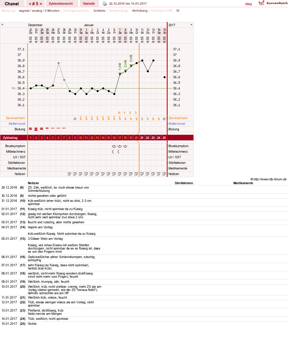 NFP-Kurve User #29040