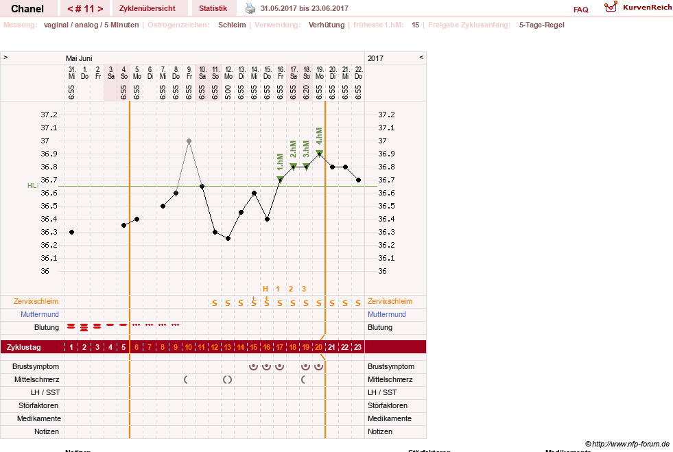 NFP-Kurve User #29040