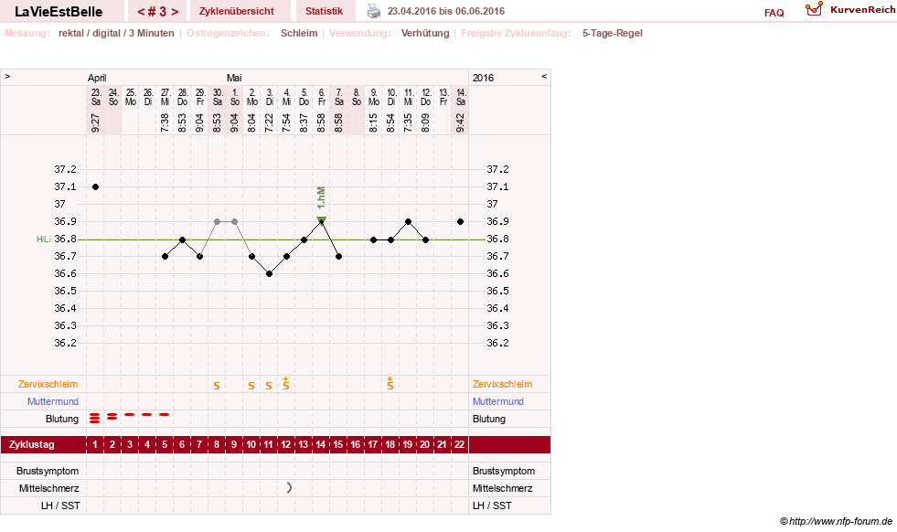 NFP-Kurve User #29121