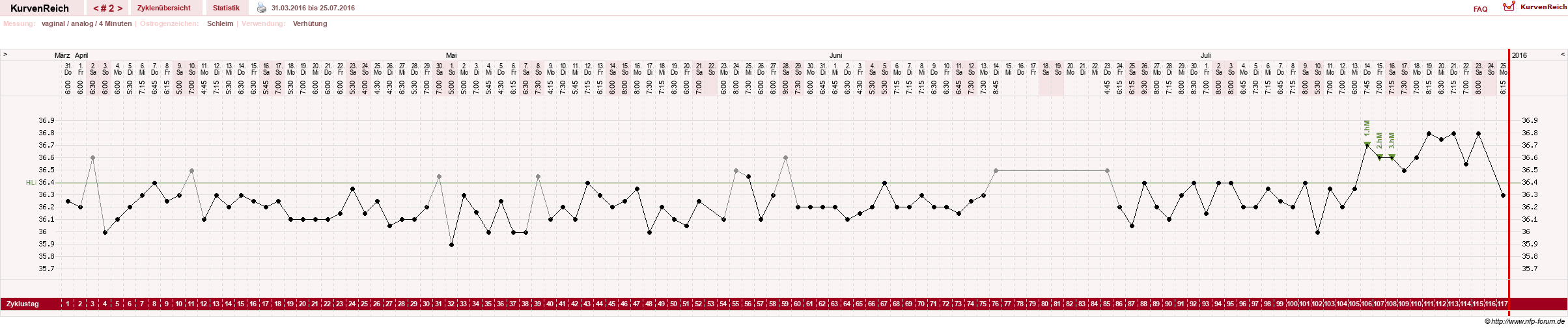 NFP-Kurve User #29124