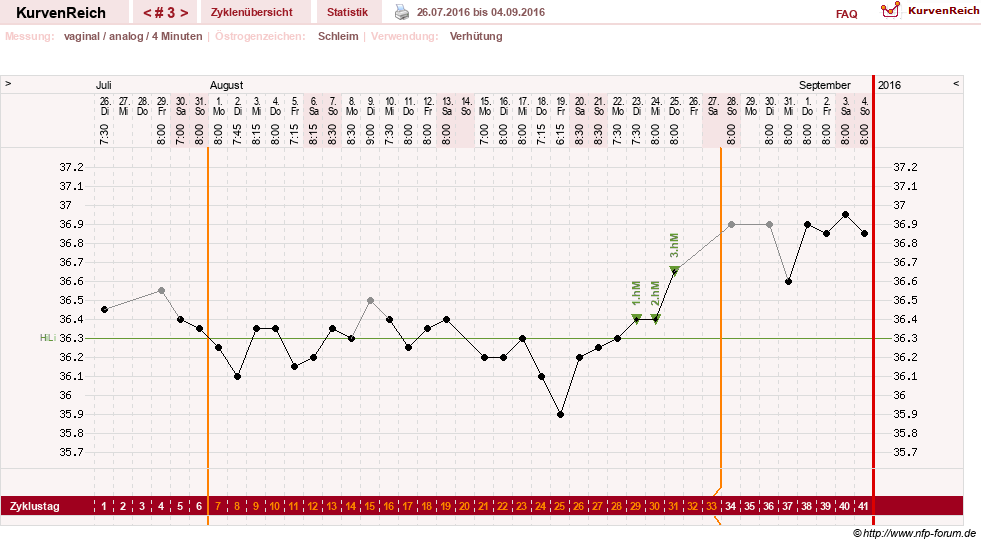 NFP-Kurve User #29124